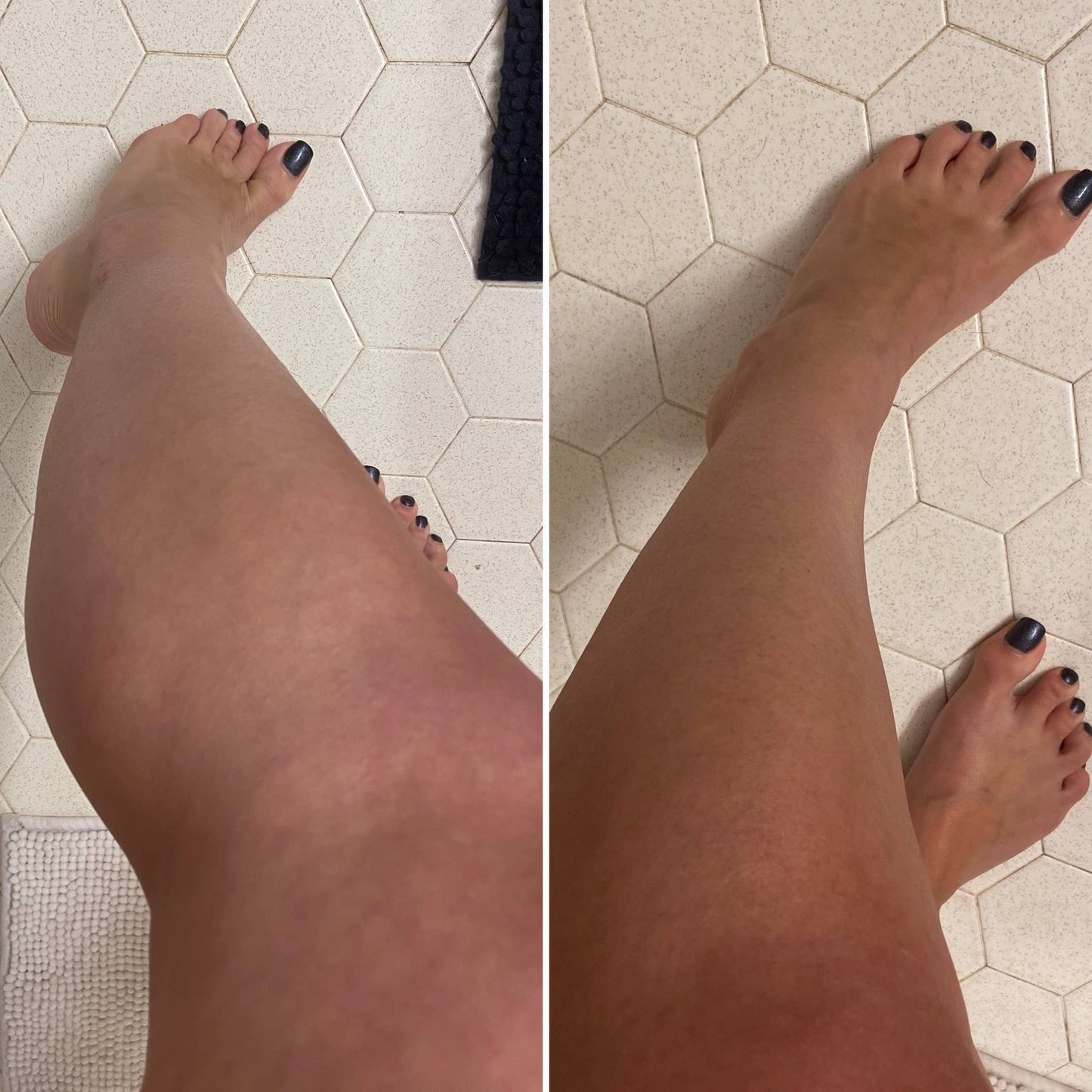 BEETTAN SELF-TANNER (bestseller)