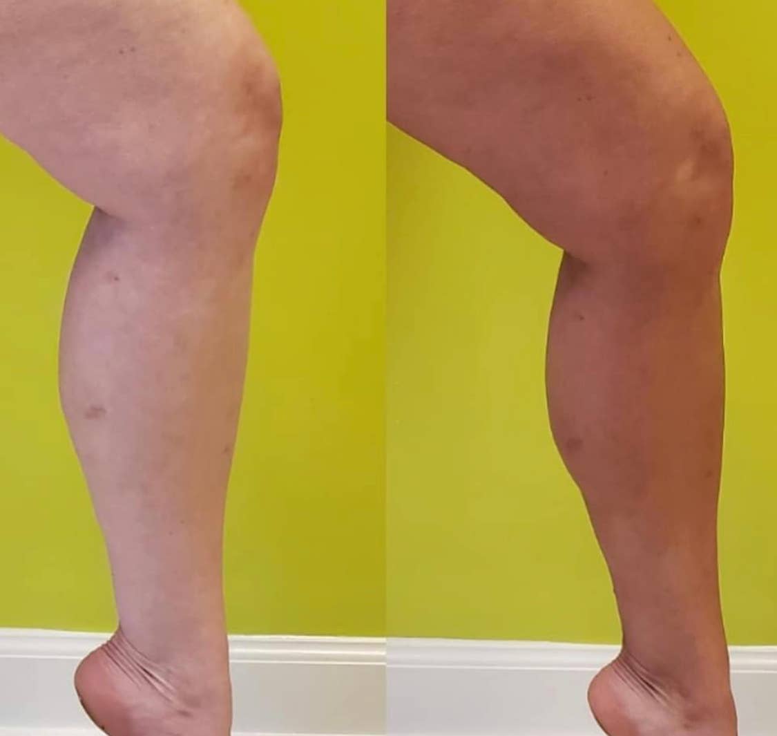 BEETTAN Self Tanning Mousse (Medium-Dark)